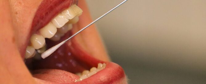 Aus einem Frauenmund wird eine Abstrich mit einem Wattestäbchen genommen.