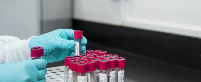 Reagenzgläser werden in einem labor in ein behältnis gesteckt.